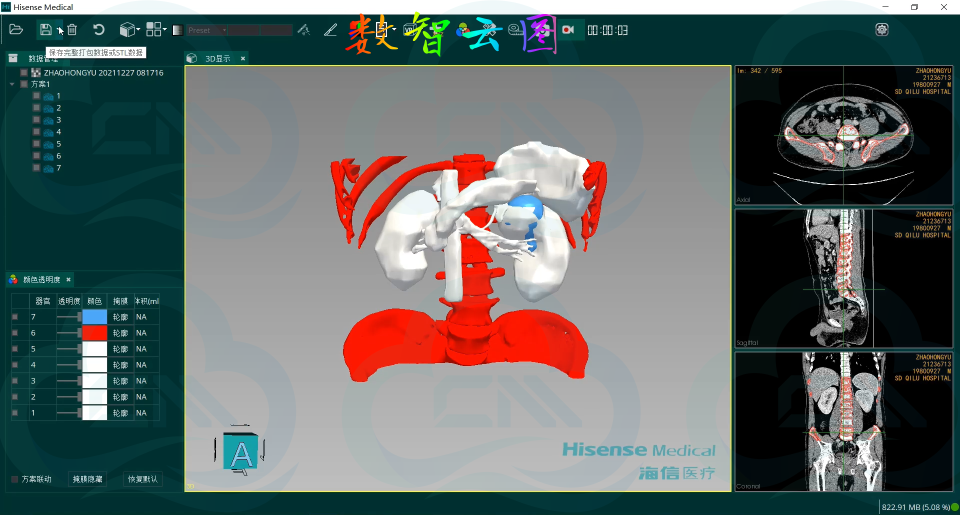 点云医疗三维重建软件